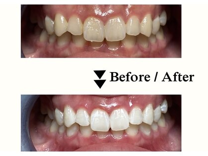 ラポ(Lapo)の写真