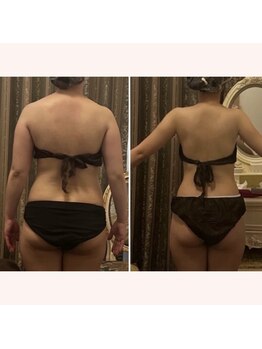 リリー ボヌール(Lily bonheur)/美腕ボディトリートメント