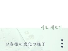 イロハ(IROHA)/ハーブピーリング/小顔/毛穴