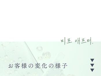 イロハ(IROHA)/ハーブピーリング/小顔/毛穴