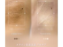 フリュール(FLEUR)の雰囲気（大注目のルメラのメラニンケア☆脇の黒ずみや色素沈着にも◎）