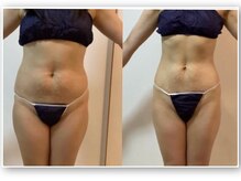 メルシー サロン(Merci Salon)の雰囲気（【40代】蓄積された脂肪を最強アプローチする痩身マシーン♪）