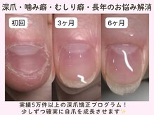 ネイルサロン プロムナード(nailsalon promnade)
