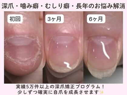 ネイルサロン プロムナード(nailsalon promnade)の写真