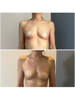 モア(moa)/50代バスト/バスト/サイズアップ