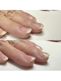 自爪育成／反り爪・わし爪