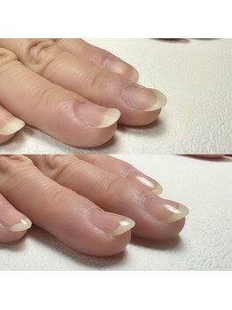 自爪育成/反り爪・わし爪