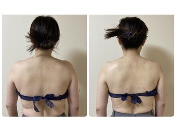 シャンタイン(SANTAI)/☆背中美人☆