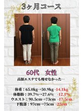 整体院日々 札幌すすきの院(hibi)/運動ゼロ◎ダイエット実績