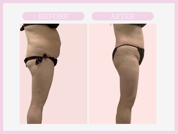 スリムライン 盛岡店(The Slim Line)/before→after