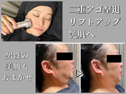 モンセルヴィ(monselvi)の写真