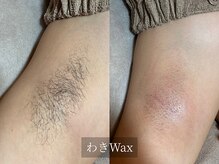 アルム(Arum)/わきWax