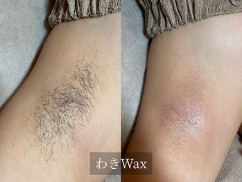 アルム(Arum)/わきWax