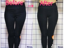 ティーラボ(T-LABO)/３０代女性の脚のラインの変化