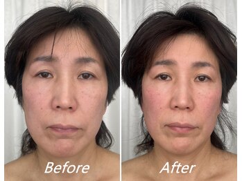 ドクターボディ 新宿店(Dr.Body)/【顔の広がり/長さ/左右差50代】