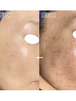 ラボーテエサンテ バイ ティアラ(la beaute et sante by Tiara)/エイジングケアが得意