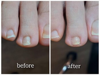 【ジェルで爪を平らに】