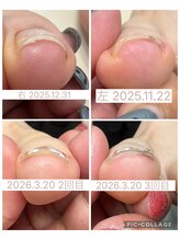 ブロックファイブハナ(Block 5 HANA)/