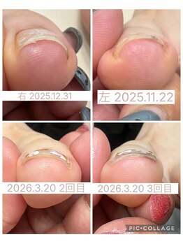 ブロックファイブハナ(Block 5 HANA)/