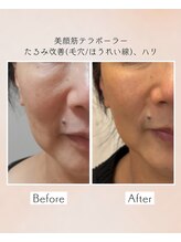 ルビーサロン(ruby-salon)/