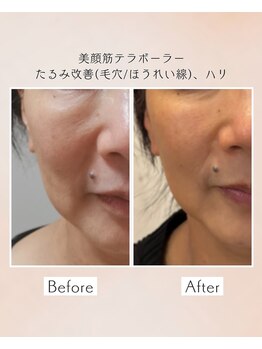 ルビーサロン(ruby-salon)/