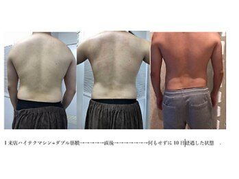 スキャニング@ラボエステ