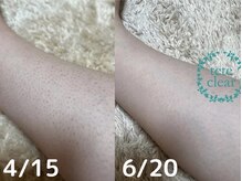 ジェリー(JERRY)/スゴイ☆