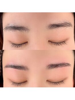 ミラ(MIRA)/《ハリウッドブロウリフト》