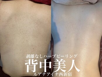 ルアナアイナ(Luana Aina)