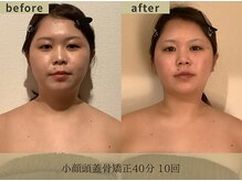 フェイシア 立川店(Facia)/before/after