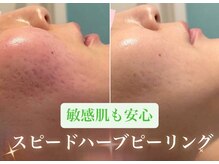 エステサロン キュート(Cute)の雰囲気（最高峰痩身マシンで貴女の綺麗を叶えてくれる♪）