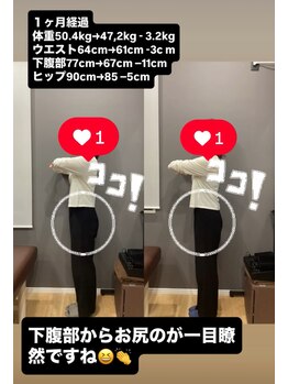 摂津本山駅前鍼灸整骨院/1ヶ月経過の写真です！30代女性