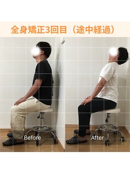 春日原りらくや整体院/肩こり全身矯正before・after