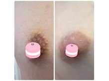 茨城初導入！！★ローマピンク★誰にも言えない黒ずみピンクに♪