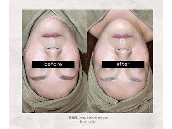 エスポワールカルド(Espoir caldo)/