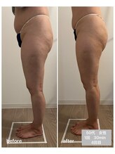 エムプラス(Mplus.)/ビジリス^_^