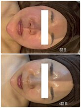 クレール(Clair)/レモンボトル