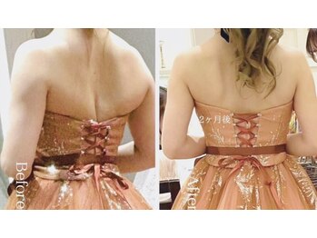 ユーフォリア グロウ(euphoria glow)の写真/【ブライダルエステ】むっちり二の腕・背肉撃退&肩甲骨・鎖骨造形コース90分スッキリ美しい肩甲骨へ♪