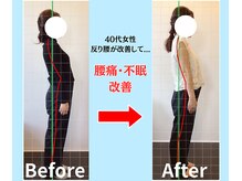 ソヴァール(SAUVEUR)/40代女性　反り腰からの腰痛不眠
