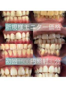エム(M)の写真/リーズナブル！セルフホワイトニング
