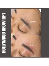 セラス(CERAS)/ハリウッドブロウリフト