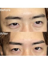 眉毛ハウス 吉祥寺店(眉毛HOUSE)/お客様の施術例(吉祥寺/東京)