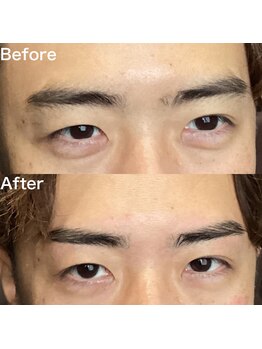 眉毛ハウス 吉祥寺店(眉毛HOUSE)/お客様の施術例(吉祥寺/東京)