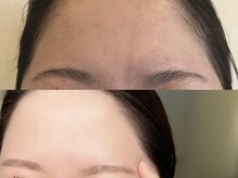 スターラッシュ 脱毛とハーブピーリングのプロ(Star Lash)の雰囲気（脱毛で満足したことのない方は当店へ◎Wax/産毛脱毛）