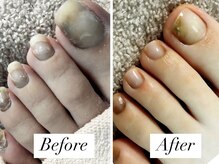 リゼラアンドコー 金沢店(LIZERA&Co)/足爪ケア