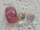 ｙｕｍｉ／フット2本コース