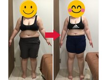 美容整体院元 光の森店/ 20代A.M様のビフォーアフター