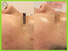 ヴィオール 名古屋栄店(VIOR)/引き締まった肌