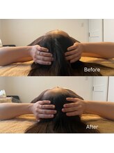 一善整骨院/一度でこの変化？？？