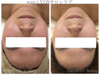 ルルボーテ(Loulou Beaute)/waxxxx+VOSサロンケア